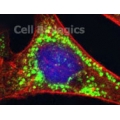 Human Tumor-Associated Fibroblasts